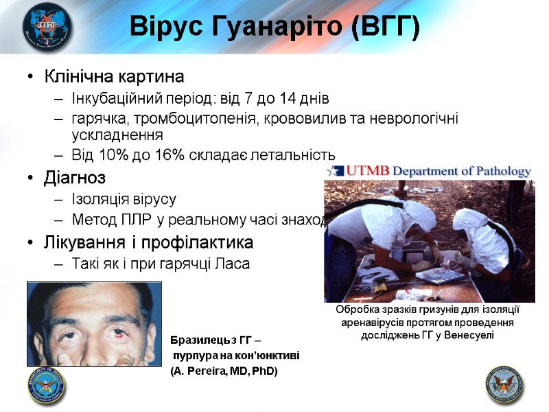 Вірус Гуанаріто (ВГГ) Клінічна картина Інкубаційний період: від 7 до 14 днів гарячка, тромбоцитопенія,